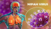 VIRUS NIPAH – SÁT THỦ MỚI VÀ CÁCH PHÒNG NGỪA